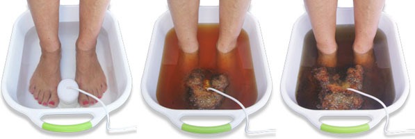 Desintoxicación Iónica